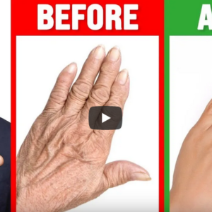 Absolute Best Remedy for Dry and Wrinkled Hands