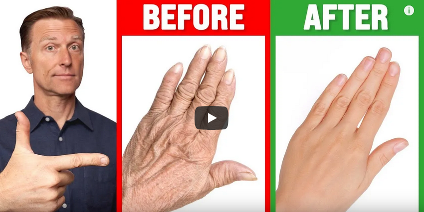 Absolute Best Remedy for Dry and Wrinkled Hands
